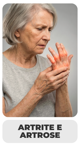 ARTRITE E ARTROSE