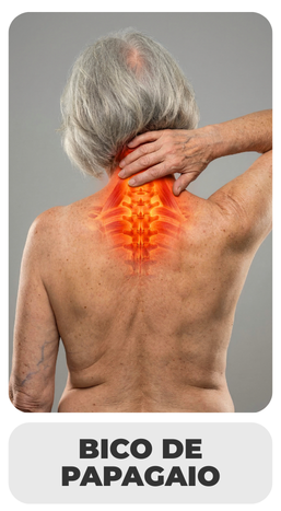 BICO DE PAPAGAIO