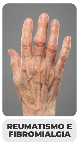 REUMATISMO E FIBROMIALGIA