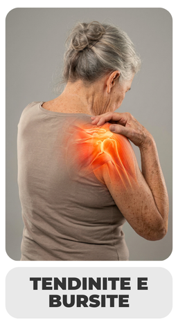 TENDINITE E BURSITE